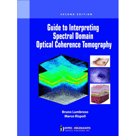 Guide to Interpreting Spectral Domain Optical Coherence Tomography book by Lumbroso, Rispoli