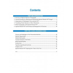 Guide to Interpreting Spectral Domain Optical Coherence Tomography book by Lumbroso, Rispoli - Additional Image 3