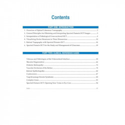 Guide to Interpreting Spectral Domain Optical Coherence Tomography book by Lumbroso, Rispoli - Additional Image 4