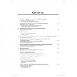 PRACTICAL HANDBOOK OF OCT ANGIOGRAPHY book by Lumbroso Bruno - Additional Image 6
