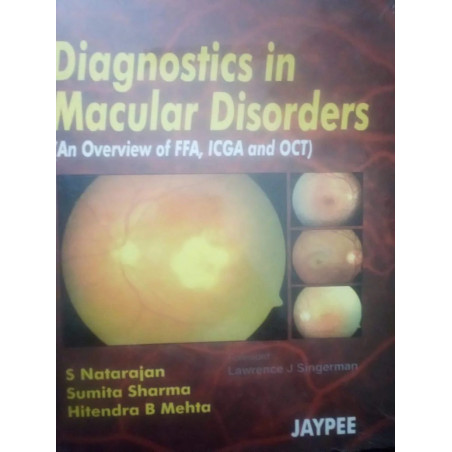 Diagnostics In Macular Disorders book by Natarajan