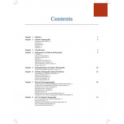 Diabetic Retinopathy (POD) book by Lumbroso Bruno - Additional Image 5