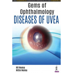 Gems in Ophthalmology—Diseases of Uvea book by HV Nema, Nitin Nema