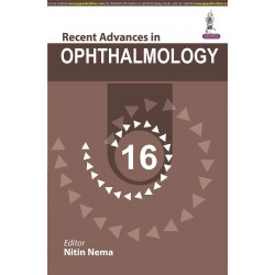 RECENT ADVANCES IN OPHTHALMOLOGY 16 book by Nitin Nema