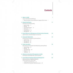 Recent Advances in Ophthalmology (Vol. 13) (POD) book by H. V. Nema, Nitin Nema - Additional Image 6