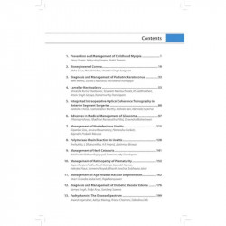 Recent Advances in Ophthalmology-17 | Updated Reviews for MS, DNB and DO Ophthalmologists on Childhood Myopia, Pediatric Ker… -
