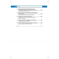Recent Advances in Ophthalmology-17 | Updated Reviews for MS, DNB and DO Ophthalmologists on Childhood Myopia, Pediatric Ker… -