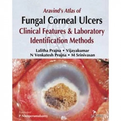 ARAVIND'S ATLAS OF FUNGAL CORNEAL ULCERS CLINICAL FEATURES & LAB.IDENTIFICATION METHODS book by Prajna