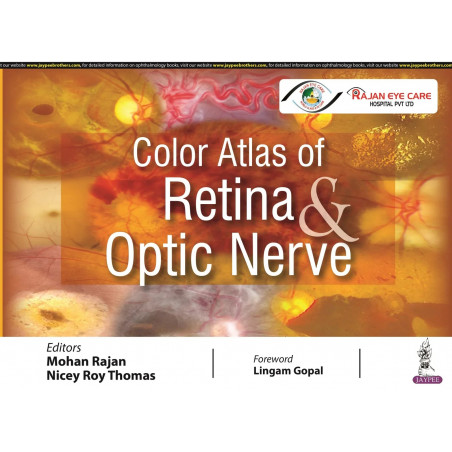 Color Atlas of Retina & Optic Nerve book by RAJAN