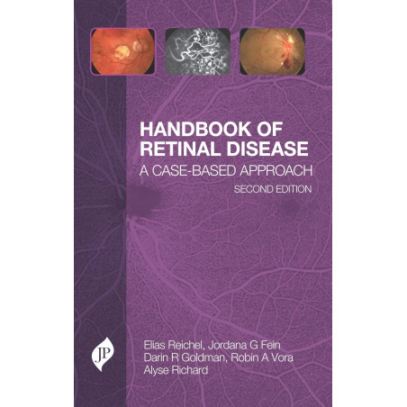 Handbook of Retinal Disease: A Case- Based Approach: A Cased-Based Approach book by Robin A Vora Elias Reichel , Jordana G F…