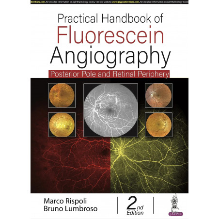 PRACTICAL HANDBOOK OF FLUORESCEIN ANGIOGRAPHY: POSTERIOR AND RETINAL PERIPHERY book by Marco Rispoli, Bruno Lumbroso