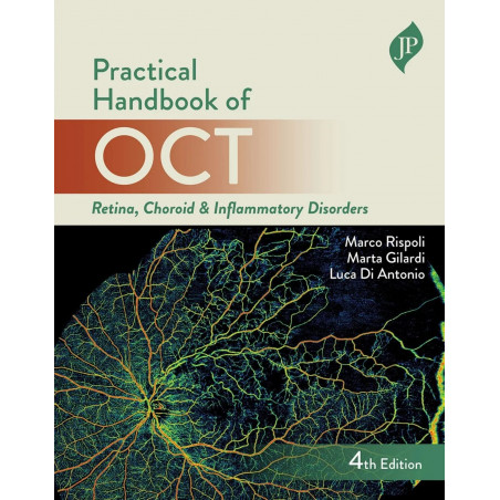 PRACTICAL HANDBOOK OF OCT RETINA, CHOROID & INFLAMMATORY DISORDERS book by Marco Rispoli, Marta Gilardi