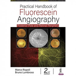 PRACTICAL HANDBOOK OF FLUORESCEIN ANGIOGRAPHY: POSTERIOR AND RETINAL PERIPHERY book by Marco Rispoli, Bruno Lumbroso - Back Cove