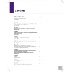 PRACTICAL HANDBOOK OF OCT RETINA, CHOROID & INFLAMMATORY DISORDERS book by Marco Rispoli, Marta Gilardi - Additional Image 5