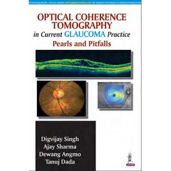 Optical Coherence Tomography in Current Glaucoma Practice Pearls and Pitfalls book by Digvijay Singh, Ajay Sharma