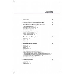 Optical Coherence Tomography in Current Glaucoma Practice Pearls and Pitfalls book by Digvijay Singh, Ajay Sharma - Additional I