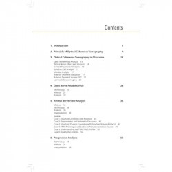 Optical Coherence Tomography in Current Glaucoma Practice Pearls and Pitfalls book by Digvijay Singh, Ajay Sharma - Additional I