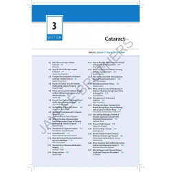 AIOS Ready Reckoner in Ophthalmology, 4/E for Ophthalmology Residents and Fellows | Quick Reference Across Cornea, Cataract,… -