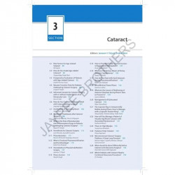 AIOS Ready Reckoner in Ophthalmology, 4/E for Ophthalmology Residents and Fellows | Quick Reference Across Cornea, Cataract,… -