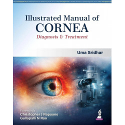 Illustrated Manual of Cornea: Diagnosis and Treatment for Ophthalmology Residents and Cornea Specialists | Corneal Disorders…