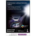 SMALL INCISION LENTICULE EXTRACTION (SMILE) SURGICAL TECHNIQUE AND CHALLENGES:COMPREHENSIVE TEXT book by Jeewan S Titiyal, M…