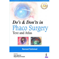 DO’S & DON’TS IN PHACO SURGERY: TEXT AND ATLAS book by Navneet Toshniwal