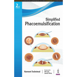 SIMPLIFIED PHACOEMULSIFICATION book by Navneet Toshniwal