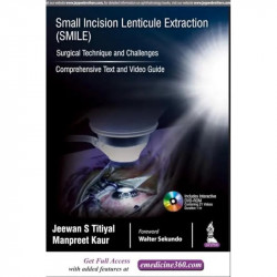 SMALL INCISION LENTICULE EXTRACTION (SMILE) SURGICAL TECHNIQUE AND CHALLENGES:COMPREHENSIVE TEXT book by Jeewan S Titiyal, M… -
