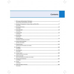 Illustrated Manual of Cornea: Diagnosis and Treatment for Ophthalmology Residents and Cornea Specialists | Corneal Disorders… -