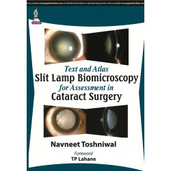 Text and Atlas Slit Lamp Biomicroscopy for Assessment in Cataract Surgery (POD) book by Toshniwal Navneet