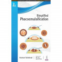 SIMPLIFIED PHACOEMULSIFICATION book by Navneet Toshniwal - Back Cover