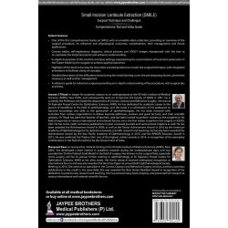 SMALL INCISION LENTICULE EXTRACTION (SMILE) SURGICAL TECHNIQUE AND CHALLENGES:COMPREHENSIVE TEXT book by Jeewan S Titiyal, M… -