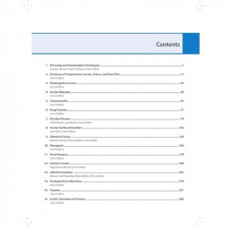 Illustrated Manual of Cornea: Diagnosis and Treatment for Ophthalmology Residents and Cornea Specialists | Corneal Disorders… -