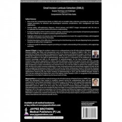 SMALL INCISION LENTICULE EXTRACTION (SMILE) SURGICAL TECHNIQUE AND CHALLENGES:COMPREHENSIVE TEXT book by Jeewan S Titiyal, M… -
