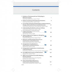 SMALL INCISION LENTICULE EXTRACTION (SMILE) SURGICAL TECHNIQUE AND CHALLENGES:COMPREHENSIVE TEXT book by Jeewan S Titiyal, M… -