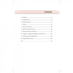 DO’S & DON’TS IN PHACO SURGERY: TEXT AND ATLAS book by Navneet Toshniwal - Additional Image 6