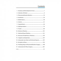 SIMPLIFIED PHACOEMULSIFICATION book by Navneet Toshniwal - Additional Image 6
