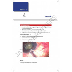 DO’S & DON’TS IN PHACO SURGERY: TEXT AND ATLAS book by Navneet Toshniwal - Additional Image 7