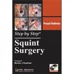 STEP BY STEP SQUINT SURGERY book by Walimbe