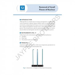 SIMPLIFIED PHACOEMULSIFICATION book by Navneet Toshniwal - Additional Image 8