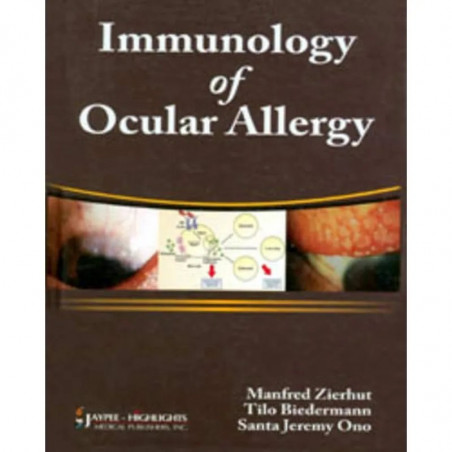 Immunology Of Ocular Allergy book by Zierhut Manfred
