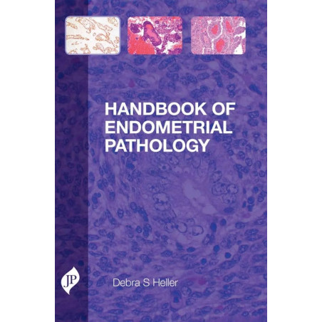 Handbook of Endometrial Pathology book by Debra S. Heller