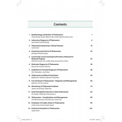 ICH Guidelines on Thalassemia 2025 for Hematologists and Pediatricians | Indian College of Hematology, ISHBT Consensus Guide… -