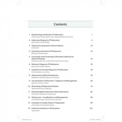 ICH Guidelines on Thalassemia 2025 for Hematologists and Pediatricians | Indian College of Hematology, ISHBT Consensus Guide… -