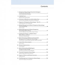 PRACTICAL GUIDE TO MANAGEMENT OF POSTPARTUM HEMORRHAGE book by Suvarna Satish Khadilkar, Preeti Nitsure-Deshpande - Additional I