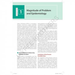 National Guidelines on Management and Control of Sickle Cell Disease for Hematologists and Medical Officers | Screening, Hyd… -