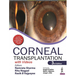 CORNEAL TRANSPLANTATION book by Namrata Sharma, Ritu Nagpal