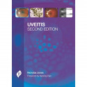 Uveitis with CD-ROM book by Jones