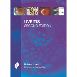 Uveitis with CD-ROM book by Jones