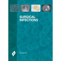 Surgical Infections book by Fry Donald
